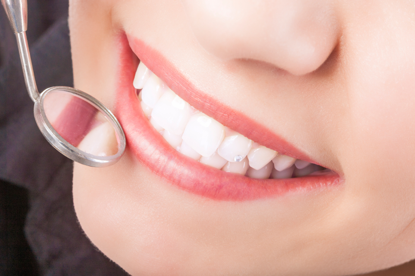 A woman smiling with Crown Lengthening in Seattle, WA.