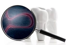 Molar teeth with magnifying glass showing bacteria at Timothy H. Kindt, DDS